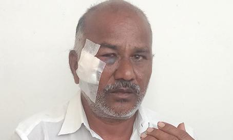 ஈரோட்டில் இன்று அதிகாலை வீடு புகுந்து வர்க்கி வியாபாரியை தாக்கி நகை-பணம் கொள்ளை