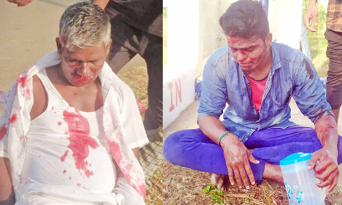 மோட்டார் சைக்கிள்கள் மோதியதில் 2 பேர் காயம்