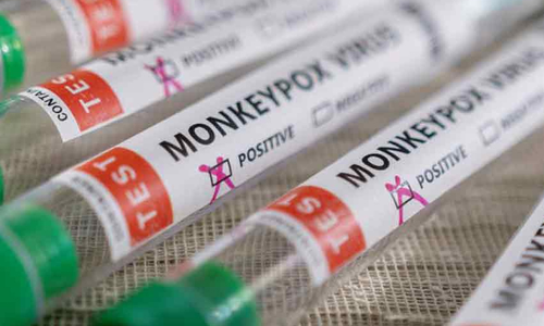 இங்கிலாந்தில் மேலும் 104 பேருக்கு குரங்கம்மை பரவல்