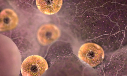 கருமுட்டை விவகாரம்- சிறுமியின் தாய், வளர்ப்பு தந்தையை காவலில் எடுத்து விசாரிக்க முடிவு