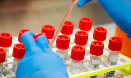 சென்னையில் காய்ச்சலுடன் வந்த 2,297 பேரில் 68 பேருக்கு கொரோனா