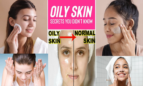 எண்ணெய் பசை சருமத்தை அழகாக பராமரிக்க என்ன செய்யலாம்...