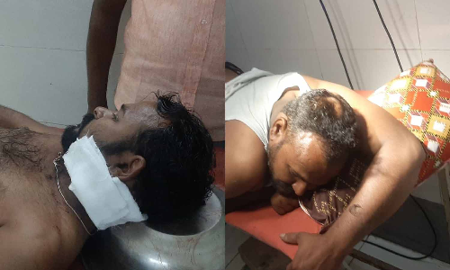 திருப்பூரில் குடிபோதையில் தகராறு: தள்ளுவண்டி கடை உரிமையாளர் உள்பட 2 பேருக்கு கத்திக்குத்து - 3 பேரை பிடித்து போலீஸ் விசாரணை