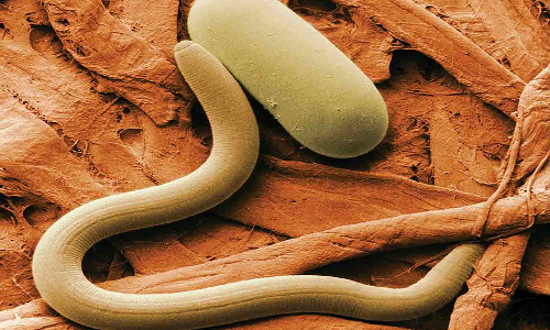 நூற்புழுக்களில் இருந்து வாழையை பாதுகாப்பது எப்படி?-  வேளாண் பேராசிரியர்கள் விளக்கம்