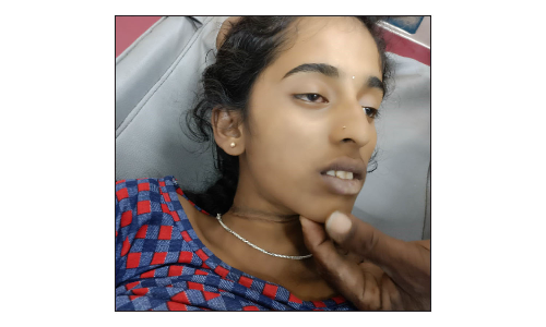 கெலமங்கலம் அருகே பரிதாபம்:  தேர்வில் தோல்வி அடைந்ததால்   உயிரை மாய்த்த பிளஸ்-1 மாணவி