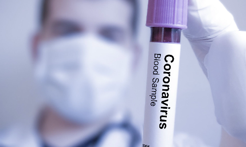 அதிகரிக்கும் கொரோனா- சென்னையில் கடந்த 24 மணி நேரத்தில் 1,025 பேருக்கு பாதிப்பு