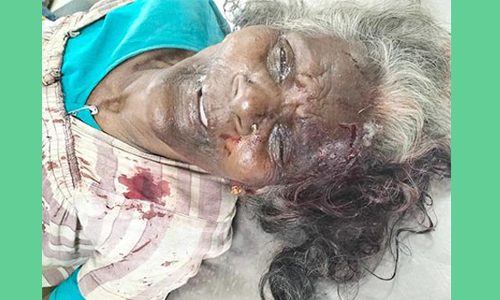 வாகனம் மோதி மூதாட்டி பலி