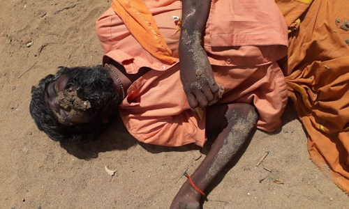 கோட்டக்குப்பம் அருகே குளக்கரையில் பிணமாக கிடந்த வாலிபர்