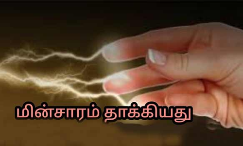 மின்சாரம் தாக்கி 7 வயது சிறுவன் காயம்