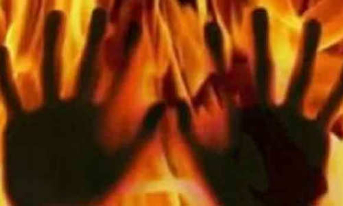 இளம்பெண் தீயில் கருகி பலி