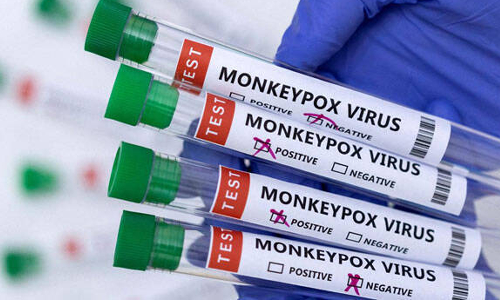 குரங்கு அம்மை நோயை சர்வதேச அவசர நிலையாக அறிவித்தது உலக சுகாதார நிறுவனம்