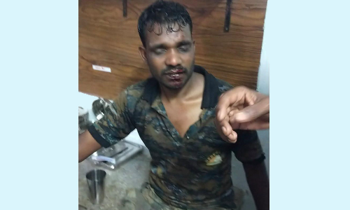 தெப்பக்காடு அருகே கரடி தாக்கி வேட்டை தடுப்பு காவலர்கள் 3 பேர் படுகாயம்