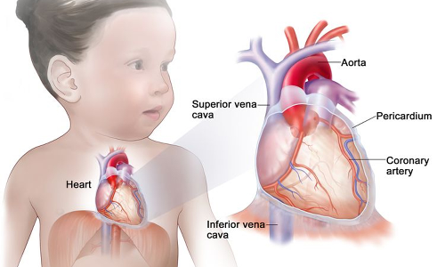 குழந்தைகளின் இதயம் பாதிக்கப்படுவதற்கு காரணங்கள்...