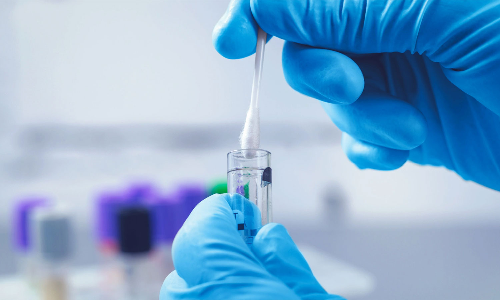 ஈரோட்டில்  கொரோனா பரிசோதனை எண்ணிக்கை அதிகரிப்பு