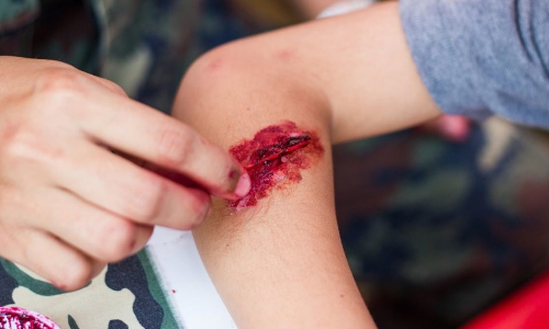 வாகன விபத்தில் 2 வாலிபர்கள் காயம்