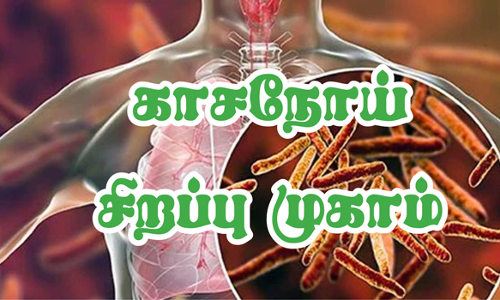 நாடமாடும் எக்ஸ்ரே வாகனம் மூலம்   காசநோய் கண்டறியும் சிறப்பு முகாம்