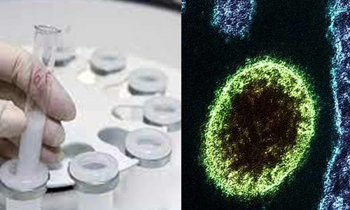 சீனாவை மிரட்டும் புதிய வகை வைரஸ்- விலங்குகளிடம் இருந்து பரவியதாக தகவல்