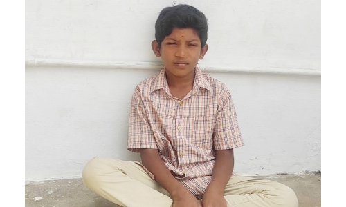 ஓசூரில்,  குண்டூசியை விழுங்கிய பள்ளி   மாணவனுக்கு தீவிர சிகிச்சை