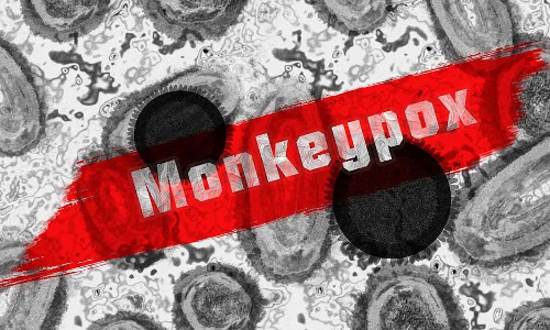 இந்தோனேசியாவிலும் குரங்கு அம்மை நோய் பாதிப்பு கண்டுபிடிப்பு