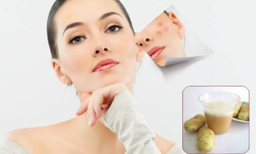 சரும பராமரிப்பில் உருளைக்கிழங்கின் முக்கிய பங்கு....