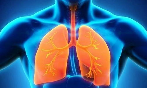 வடசென்னை மக்களை வாட்டி வதைக்கும் நச்சு காற்று- ஆஸ்துமா, நுரையீரல் பாதிப்பு அதிகரிக்கும் அபாயம்