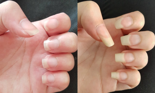 நீளமான நகம் வேண்டுமா? அப்ப இதை செய்யுங்க...