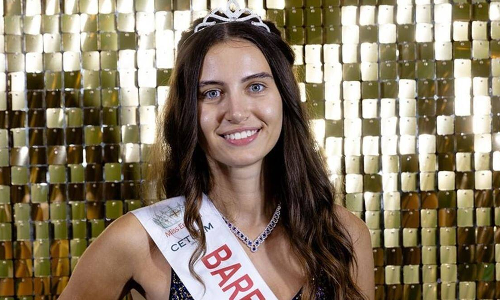 இங்கிலாந்து அழகி போட்டியில் ஒப்பனை இல்லாமல் இறுதிச்சுற்றுக்கு முன்னேறிய அழகி