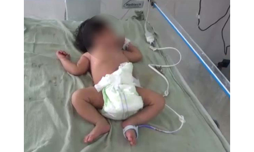 கிருஷ்ணகிரி அருகே  அரசு ஆரம்ப சுகாதார நிலையத்தில் பிரசவித்த பெண் மீது விழுந்த மின்விசிறி   -உயிர்தப்பிய பச்சிளங்குழந்தை