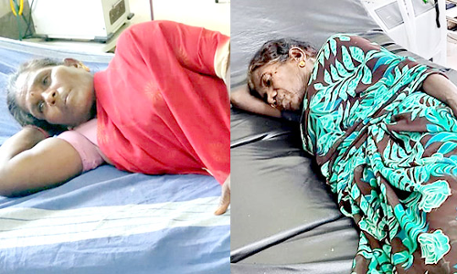 கதண்டு கடித்து 3 பெண்கள் காயம்