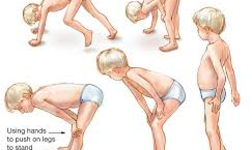 மாற்றுத்திறனாளி குழந்தைகளுக்கு தசை இயக்க பயிற்சி