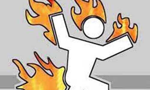 தொழிலாளி தீக்குளித்து சாவு