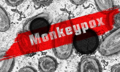 டெல்லியில் நைஜீரிய பெண்ணுக்கு குரங்கம்மை பாதிப்பு