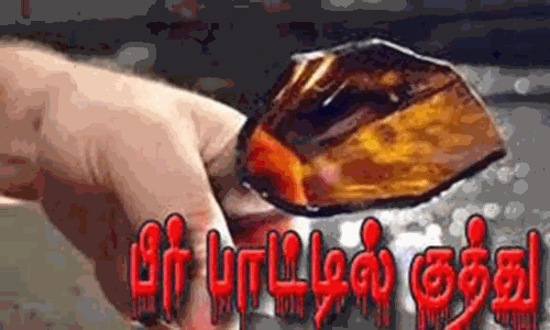 கடனை திருப்பி கேட்ட  சமையல்காரருக்கு பீர் பாட்டில் குத்து