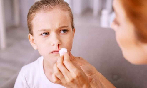 குழந்தைகளுக்கு மூக்கில் இருந்து ரத்தம் வர காரணங்கள்