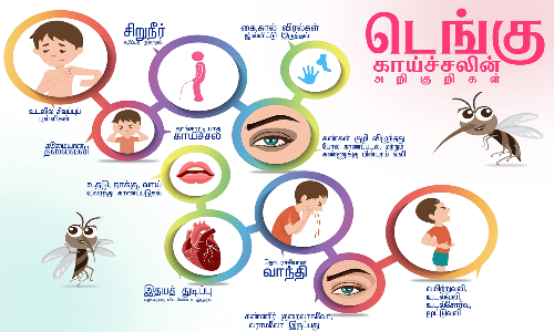 வேலூரில் மேலும் 2 பேருக்கு டெங்கு காய்ச்சல் அறிகுறி