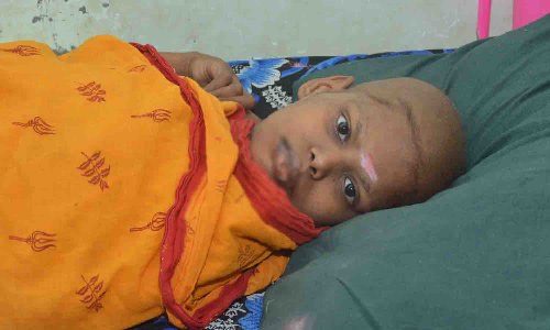 கிருஷ்ணகிரி அருகே பரிதாபம்:  பதக்கங்களை குவித்த மாணவியை பரிதவிக்க வைத்த புற்று நோய்   -குணப்படுத்த வசதியின்றி தவிக்கும் பெற்றோர்