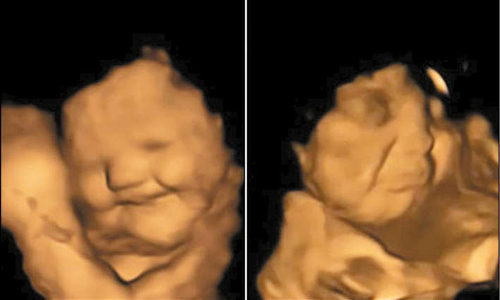 கருவில் இருக்கும் குழந்தைகளுக்கு கேரட் சுவை பிடிக்கும்: ஆராய்ச்சி தகவல்