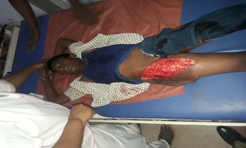 ஏற முயன்றபோது தவறி விழுந்தான் அரசு பஸ் சக்கரத்தில் சிக்கிய  7-ம் வகுப்பு மாணவன்