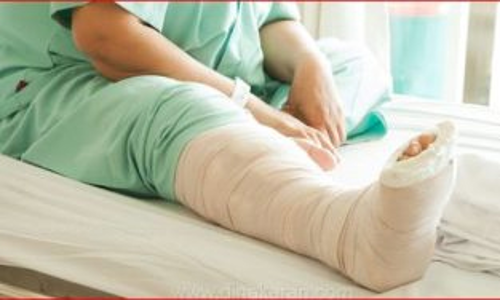 கார் மோதி தலைமை ஆசிரியை கால் முறிவு