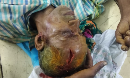 சூளகிரி அருகே வீடு கட்டுவதில் மோதல்:  இருதரப்பை சேர்ந்த 6 பேர் காயம்