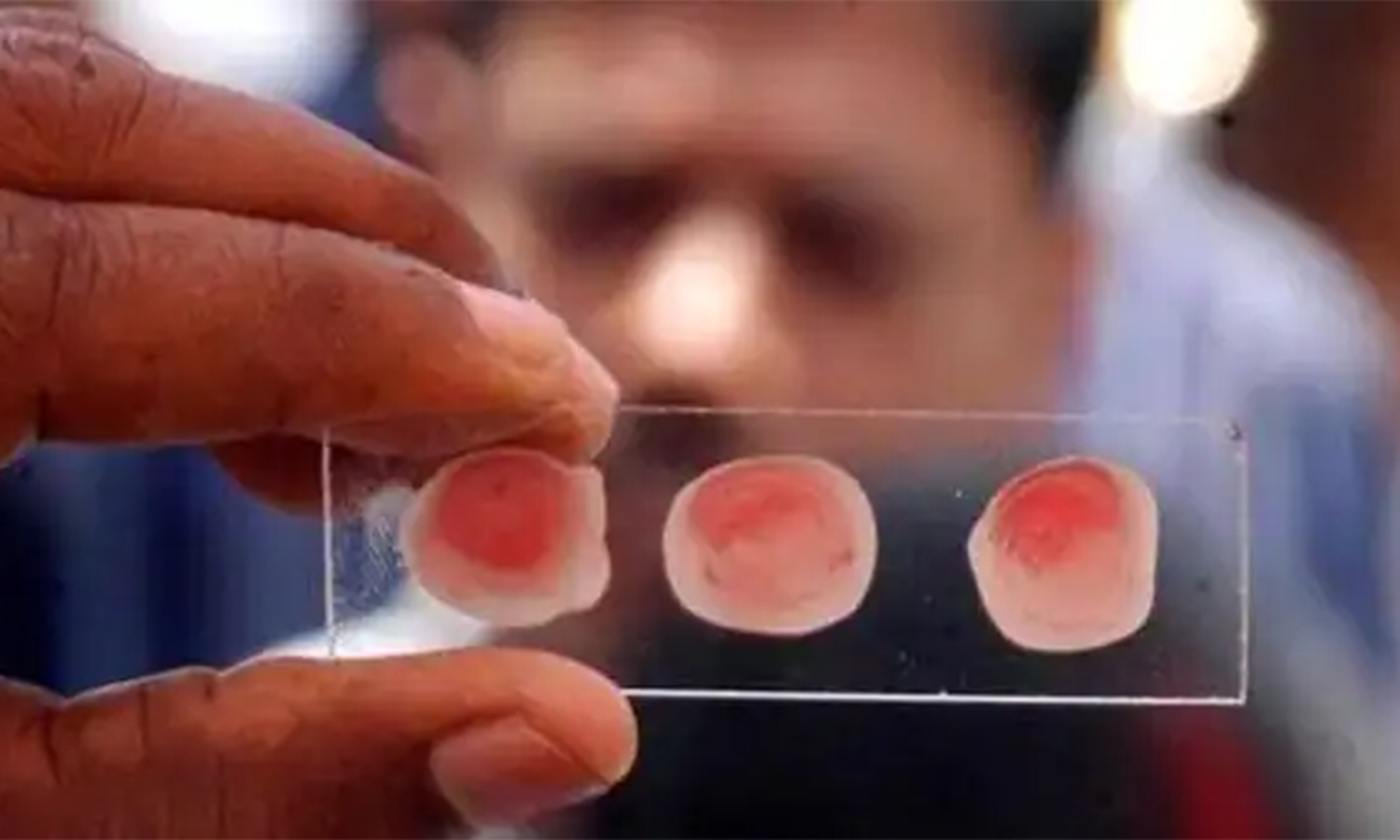 தங்க ரத்தம் பற்றி தெரியுமா? தங்க ரத்தம் பற்றி தெரியுமா?