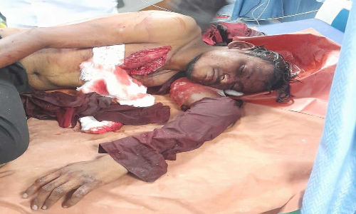 கன்னியாகுமரியில் நள்ளிரவில் நடுரோட்டில் ரத்த காயங்களுடன் உயிருக்கு போராடிக் கொண்டிருந்த வாலிபர்