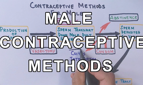 ஆண்கள் கருத்தடை சிகிச்சை மேற்கொண்டால் அந்த பிரச்சனை வருமா?
