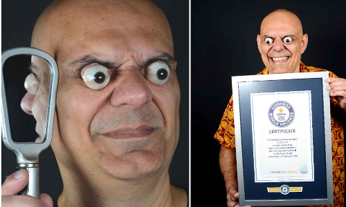 மிரட்டும் முட்டைக் கண்கள்- கின்னஸ் சாதனை படைத்த பிரேசில் மனிதர்