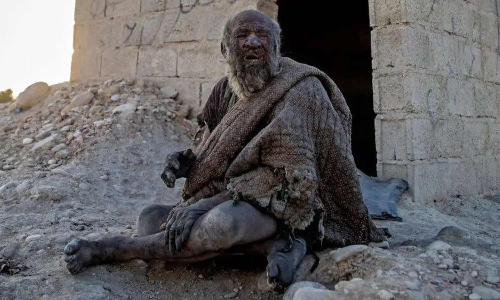 50 ஆண்டுகளாக குளிக்கவில்லை- உலகின் அழுக்கு மனிதர் காலமானார்