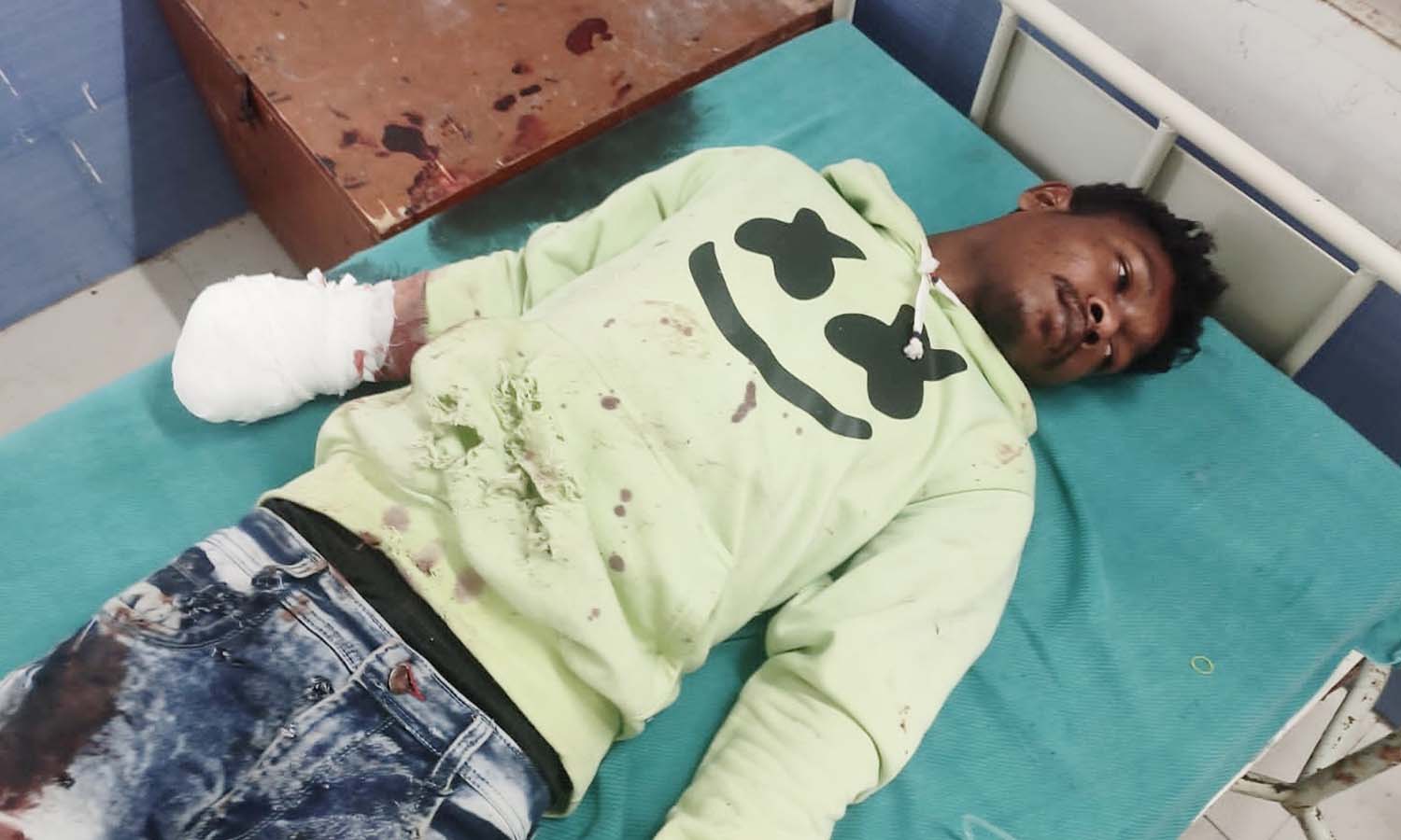 ஓசூரில் பாதுகாப்பின்றி பட்டாசு வெடித்த வாலிபர்: மதுபோதை கேளிக் கையால் கையை இழந்த பரிதாபம் ஓசூரில் பாதுகாப்பின்றி பட்டாசு வெடித்த வாலிபர்: மதுபோதை கேளிக் கையால் கையை இழந்த பரிதாபம்