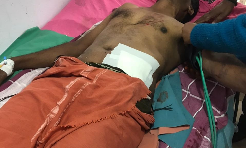 நீலகிரியில் காட்டெருமை தாக்கி வனக்காப்பாளா் காயம்