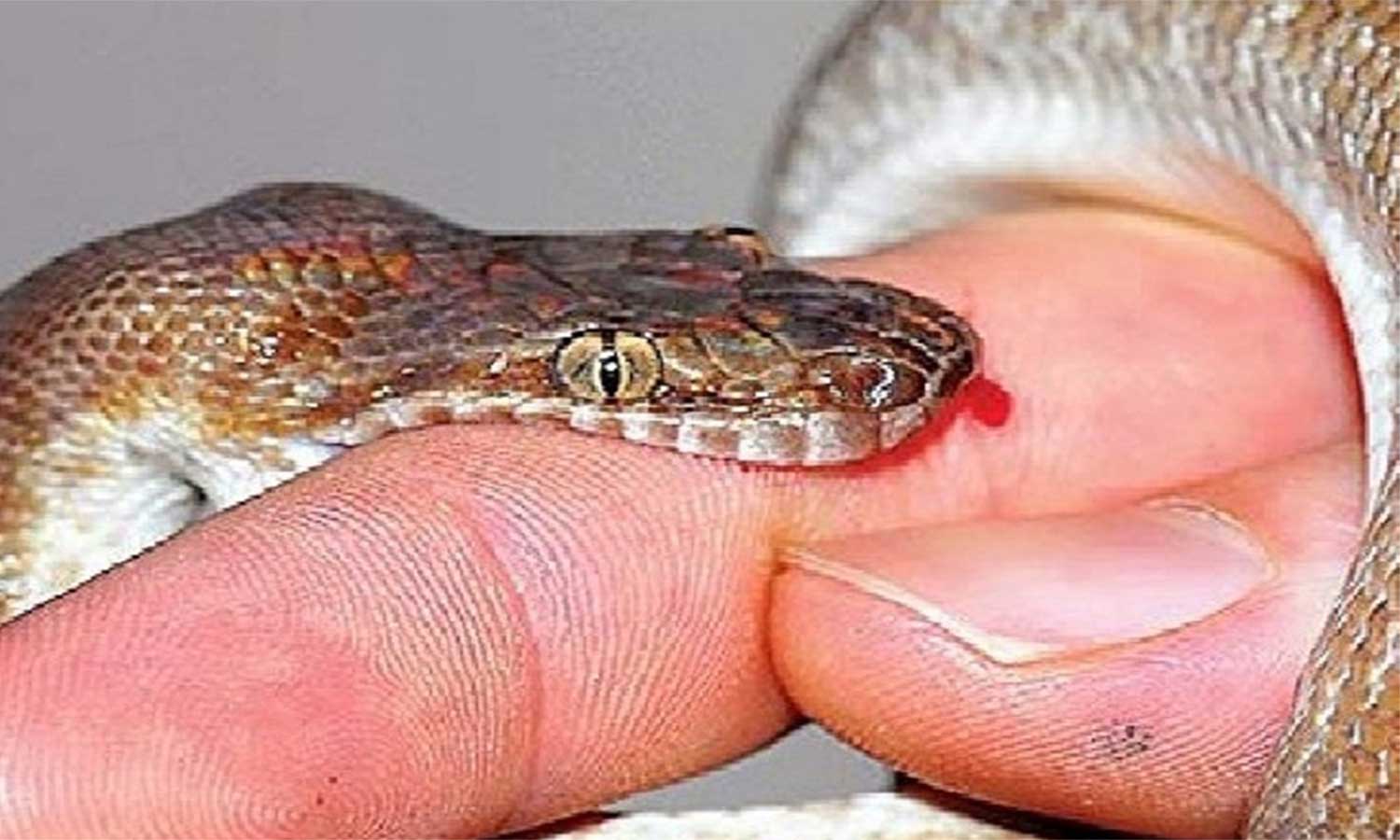 தீயணைப்பு வீரரை பாம்பு கடித்தது