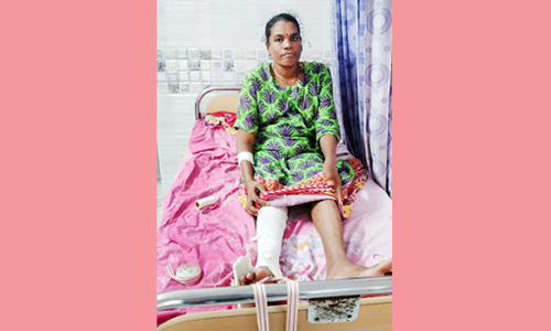 பெண்ணுக்கு இடுப்பு எலும்பு மூட்டு மாற்று அறுவை சிகிச்சை