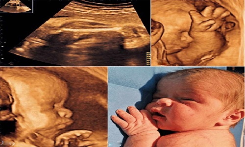 மருத்துவமனையில் குழந்தை இறந்து பிறக்க காரணம் என்ன?